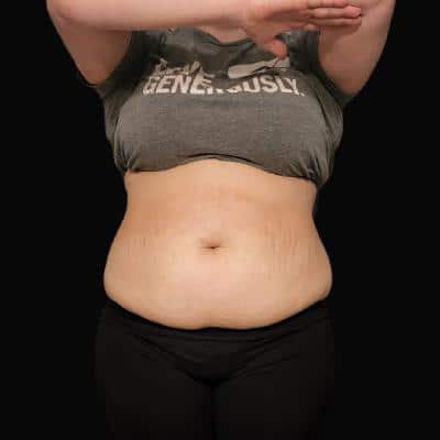 FAT REDUCTION